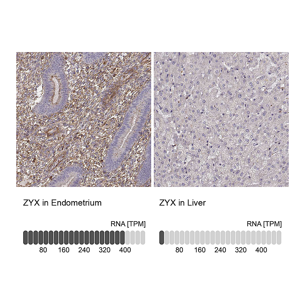 Atlas Antibodies Anti-ZYX Antibody
