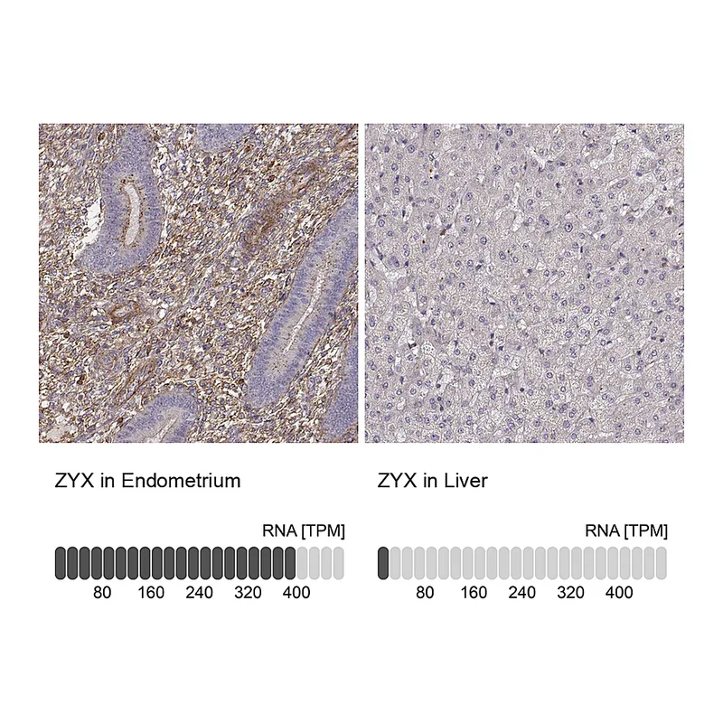 Atlas Antibodies Anti-ZYX Antibody