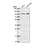 Atlas Antibodies Anti-ZXDC Antibody