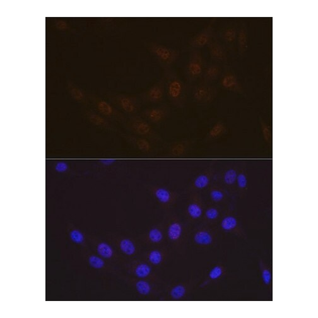 Merck Anti-Rad23A antibody produced in rabbit