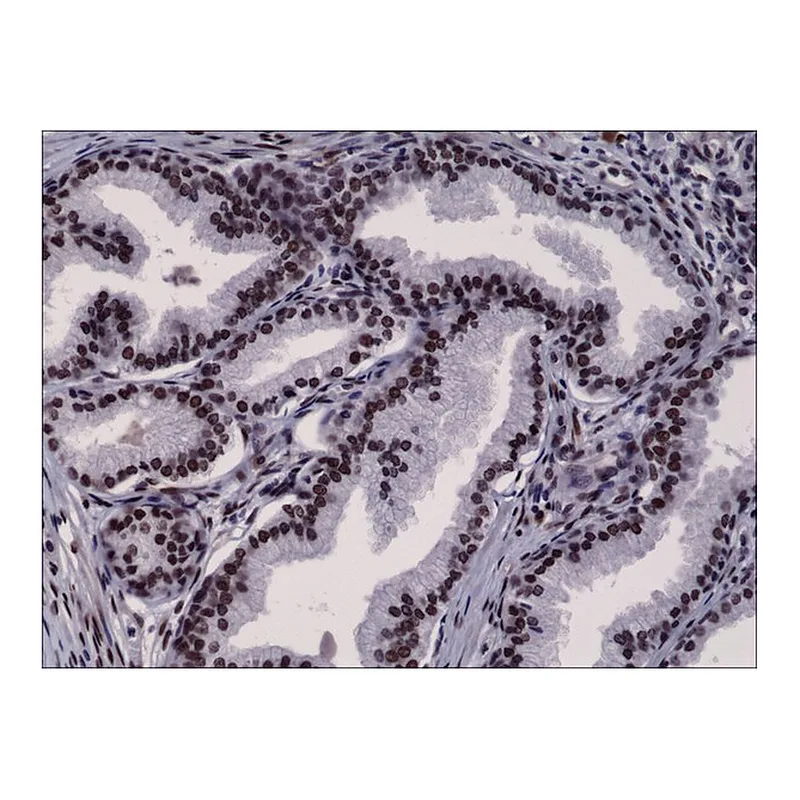 Merck Anti-AR (n-terminal) antibody, Rabbit monoclonal