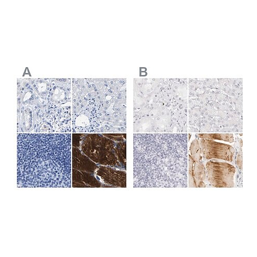 Merck Anti-MYBPC1 antibody produced in rabbit