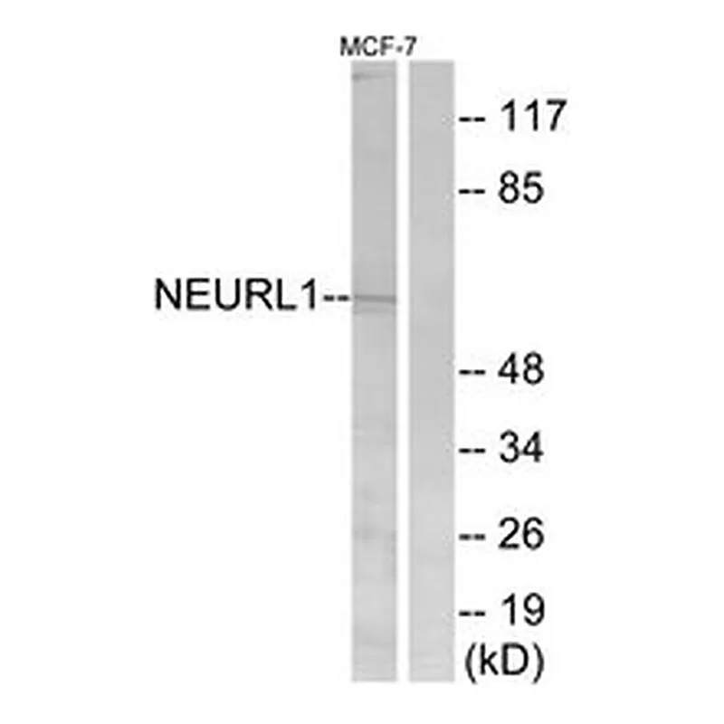 Merck ANTI-NEURL1