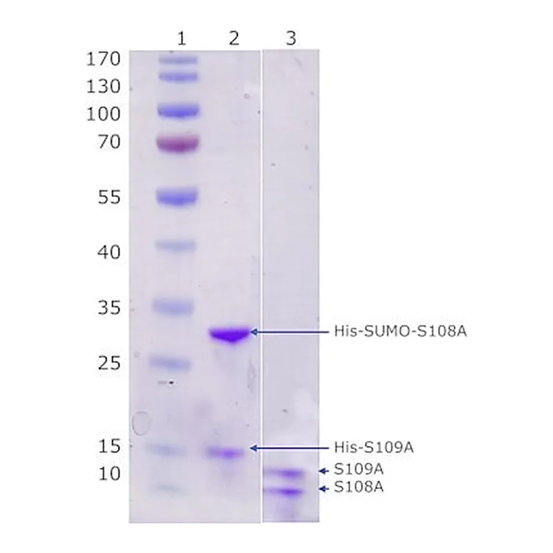 Merck Calprotectin,human recombinant