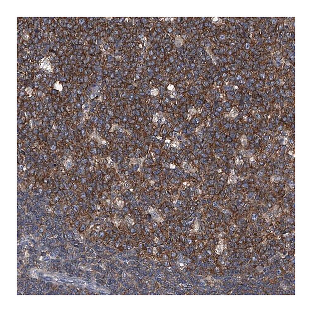 Merck Anti-PIP5K1A antibody produced in rabbit
