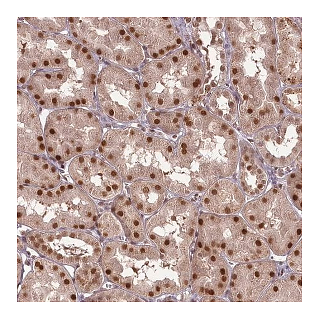Merck Anti-CEP83 antibody produced in rabbit