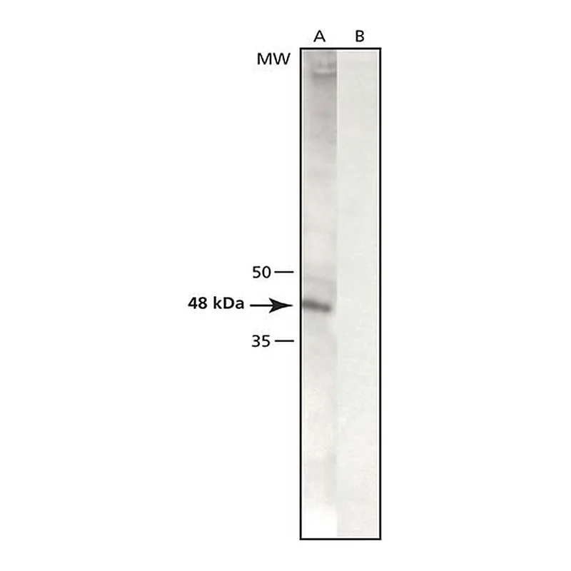 Merck Anti-gamma-Tubulin (LL-17) antibody produced in rabbit