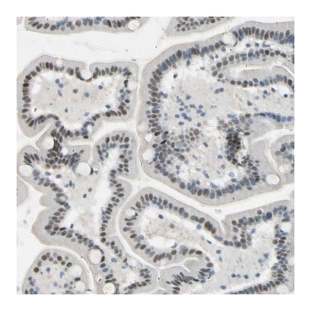 Merck Anti-RNF43 antibody produced in rabbit