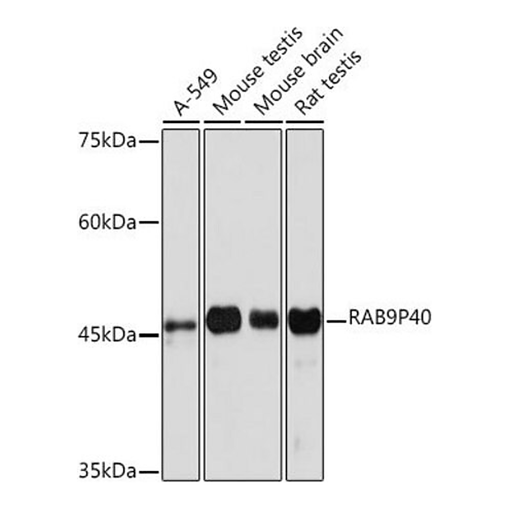 Merck Anti-RAB9P40 antibody produced in rabbit
