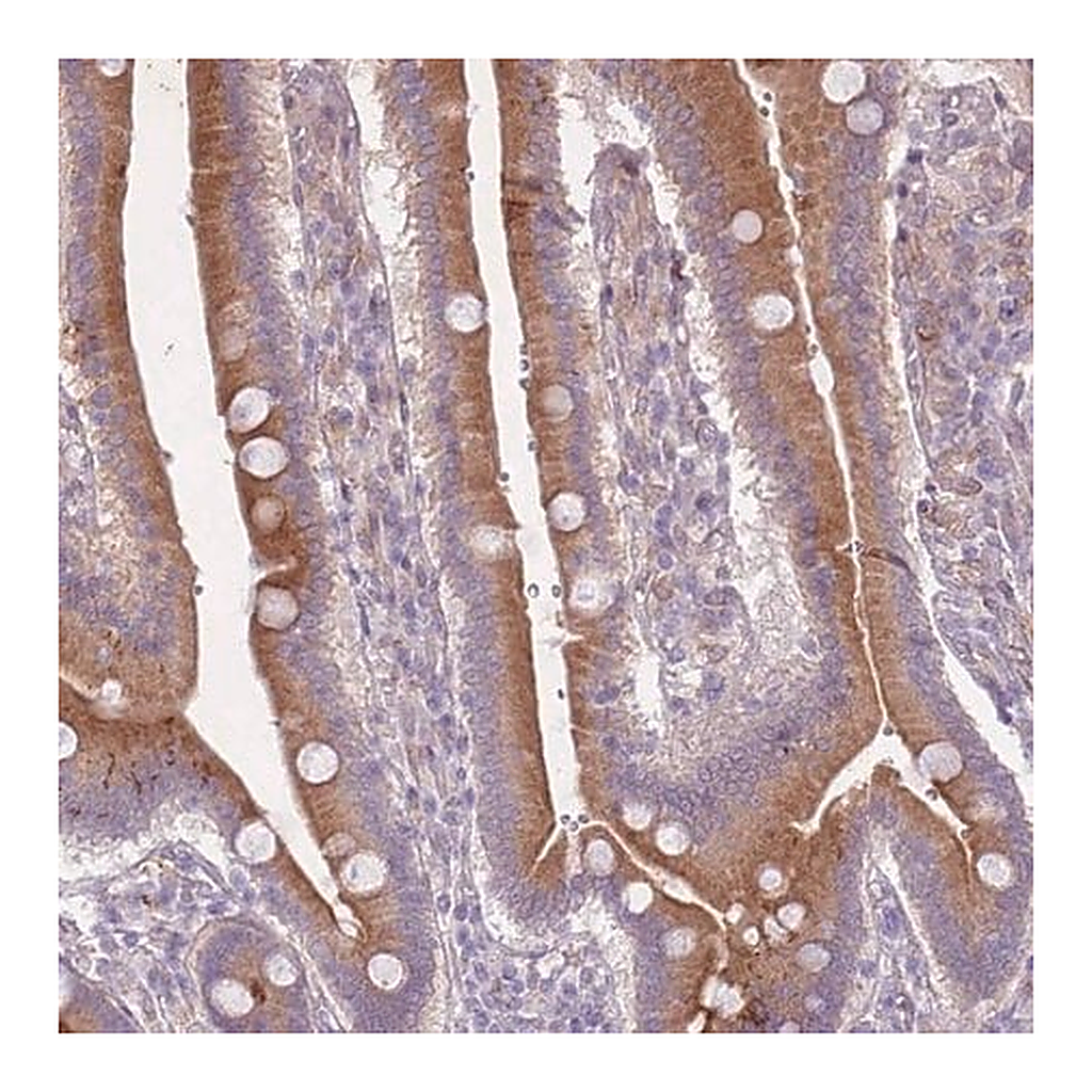 Merck Anti-ARPIN antibody produced in rabbit