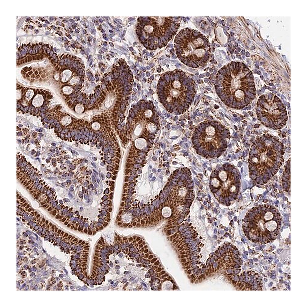 Merck Anti-TTC4 antibody produced in rabbit