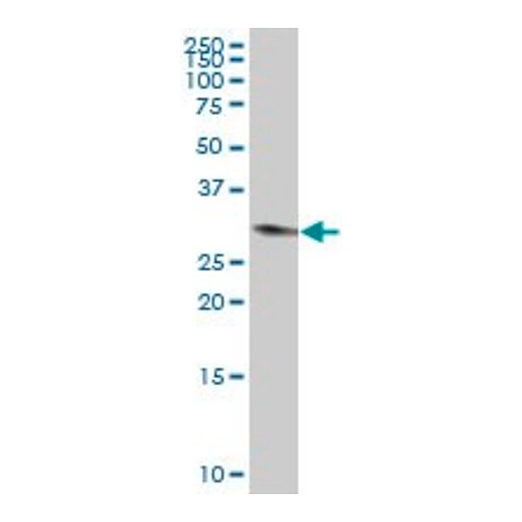 Merck Anti-TPSAB1 antibody produced in mouse