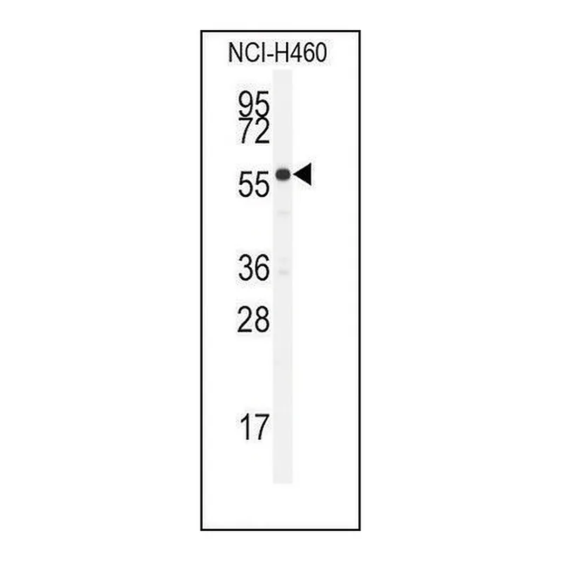 Merck Anti-CYP21A2 (N-term) antibody produced in rabbit
