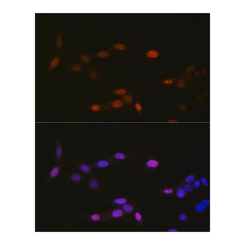 Merck Anti-MonoMethyl-Histone H3-K14 antibody produced in rabbit