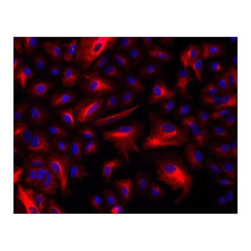 Thermo Fisher Scientific Donkey anti-Rabbit IgG (H+L) Highly Cross-Adsorbed Secondary Antibody, Alexa Fluor Plus 555