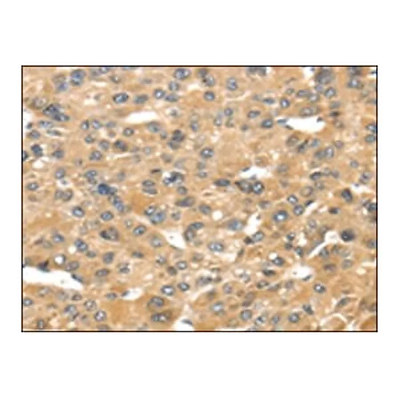 Merck ANTI-UCP1