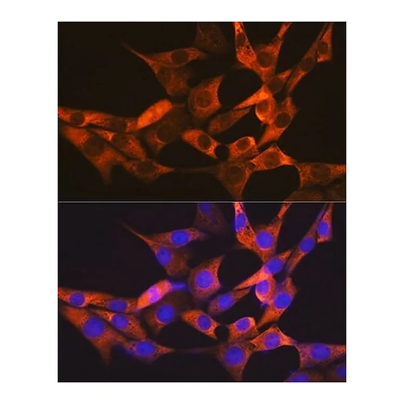 Merck Anti-FABP1 antibody produced in rabbit