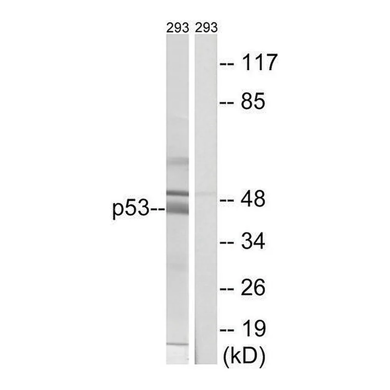 Merck Anti-p53 antibody produced in rabbit