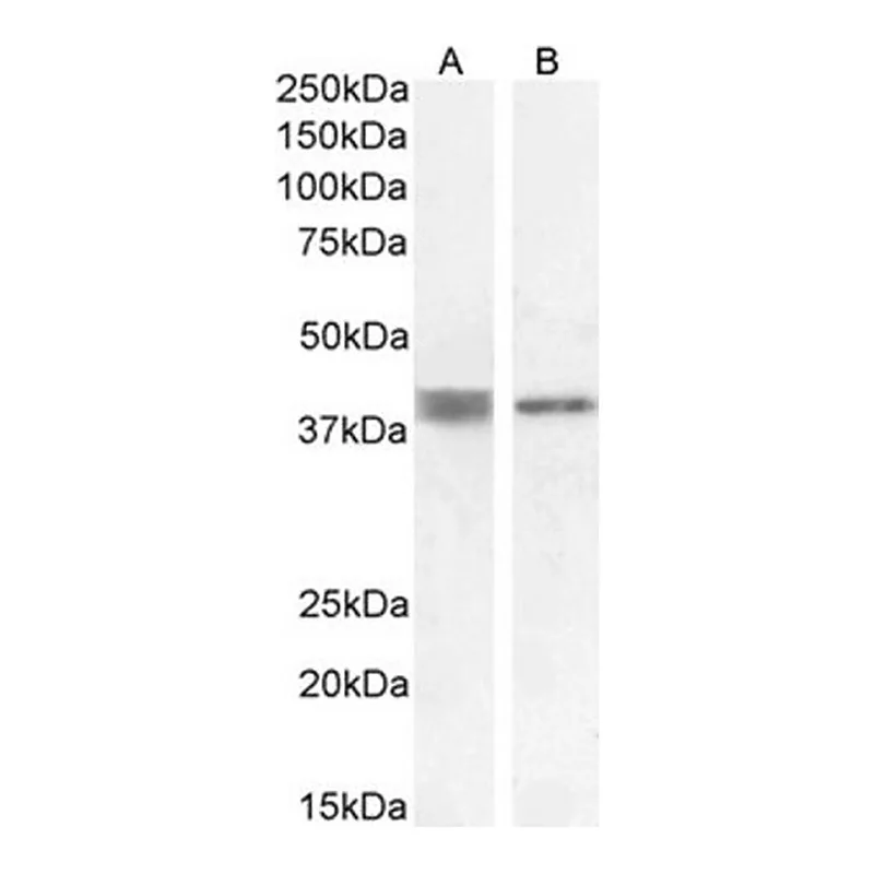 Merck Anti-ATP6IP2/Renin Receptor antibody produced in goat