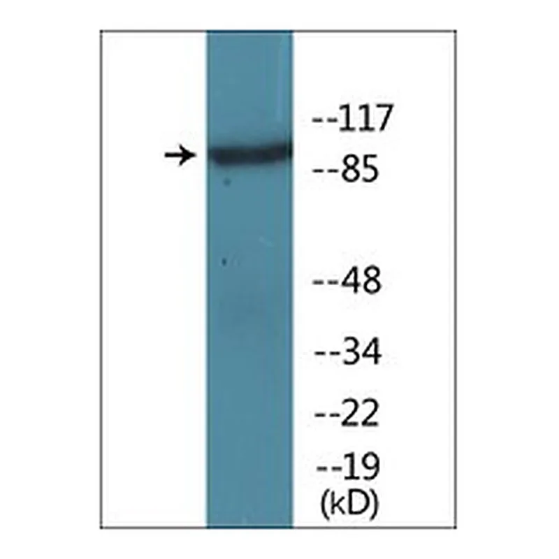 Merck ANTI-PHOSPHO-IL-4R/CD124 (PTYR497)