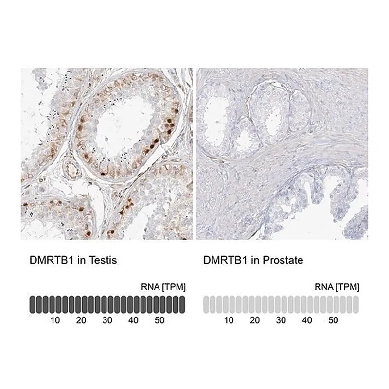 Merck Anti-DMRTB1 antibody produced in rabbit