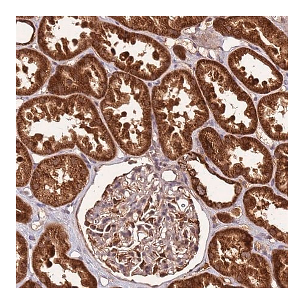Merck Anti-LYPLAL1 antibody produced in rabbit