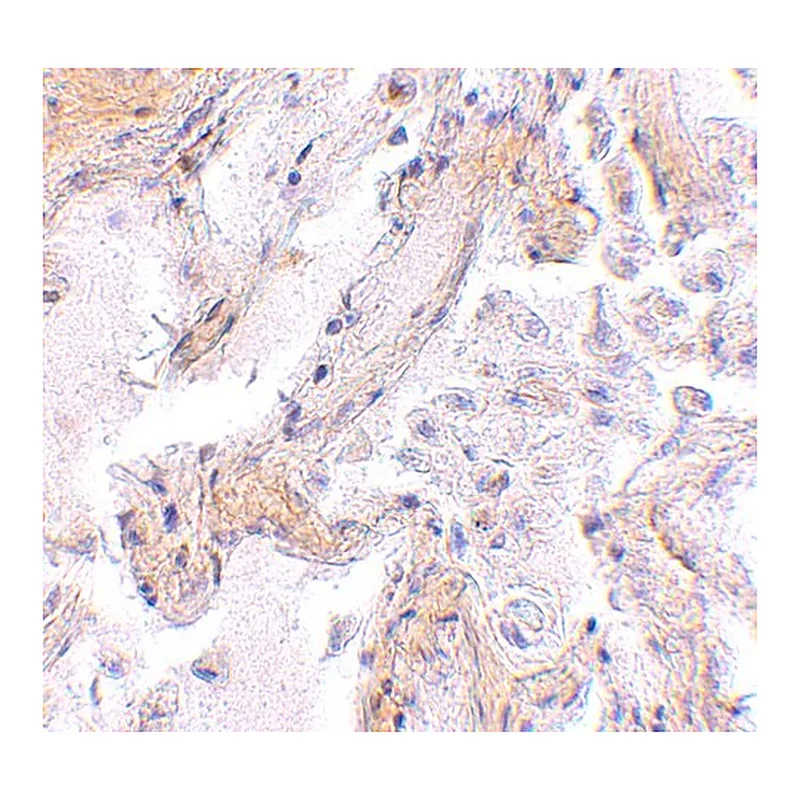Merck Anti-CAPN6 antibody produced in rabbit