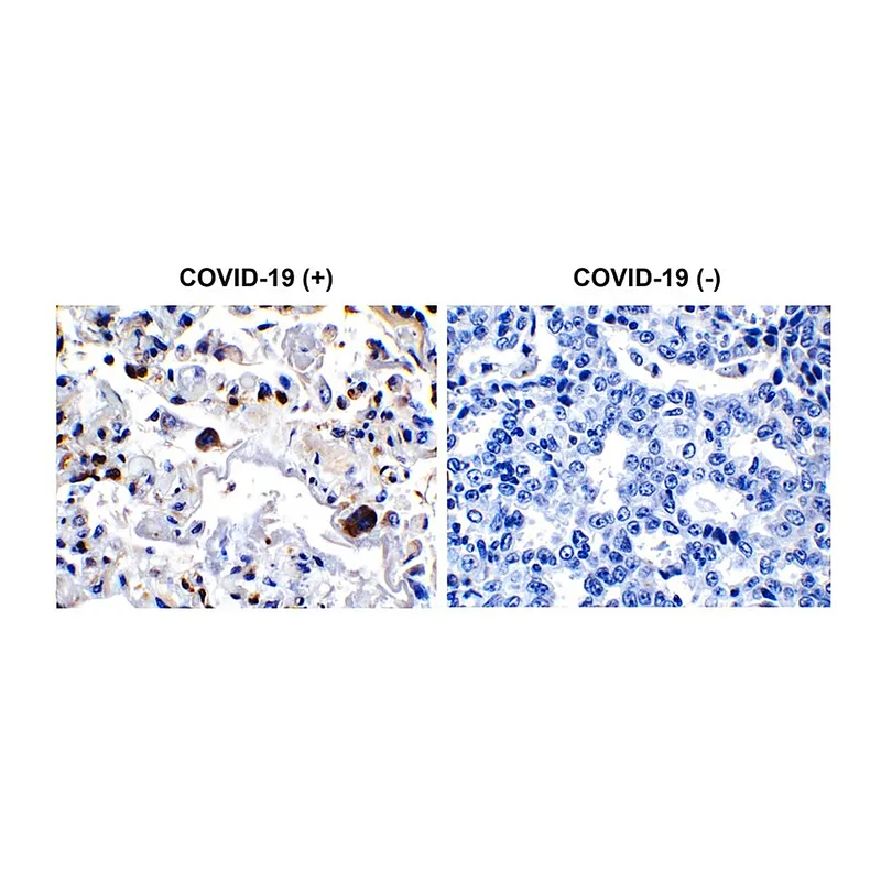 Merck Anti-SARS-CoV-2 (COVID-19) 3CL-PRO (NSP5) antibody produced in rabbit