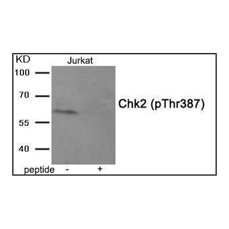Merck Anti-phospho-Chk2 (pThr387) antibody produced in rabbit