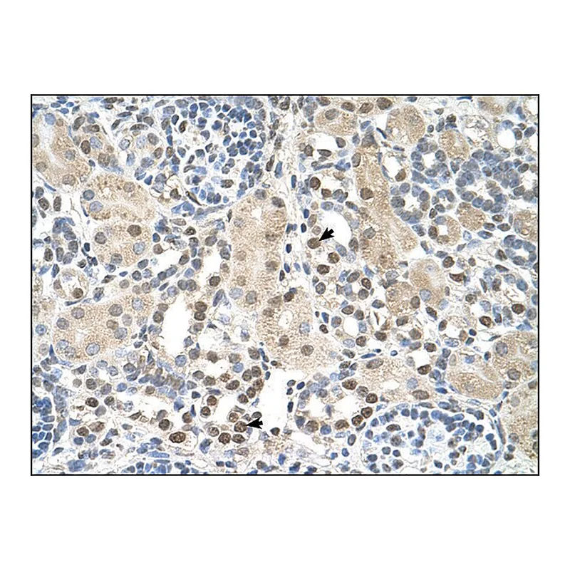 Merck Anti-PSAT1 antibody produced in rabbit
