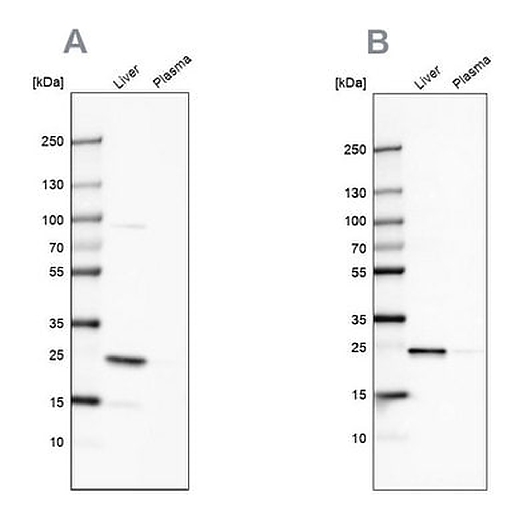 Merck Anti-CRP antibody produced in rabbit