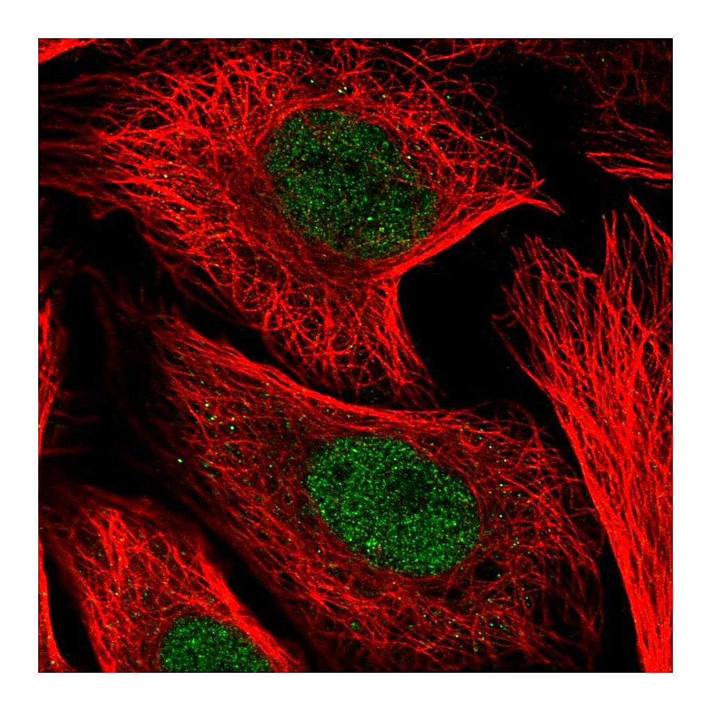 Atlas Antibodies Anti-KDELC1 Antibody