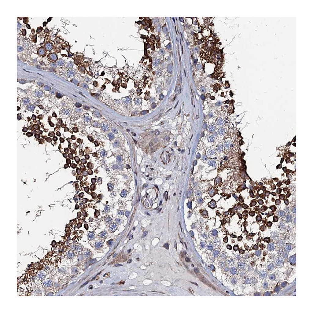 Atlas Antibodies Anti-KCTD4 Antibody