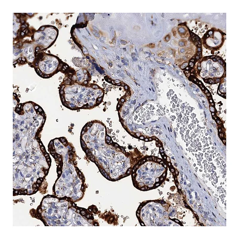 Atlas Antibodies Anti-KDELC2 Antibody