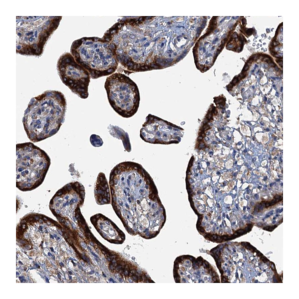 Atlas Antibodies Anti-KDELC2 Antibody