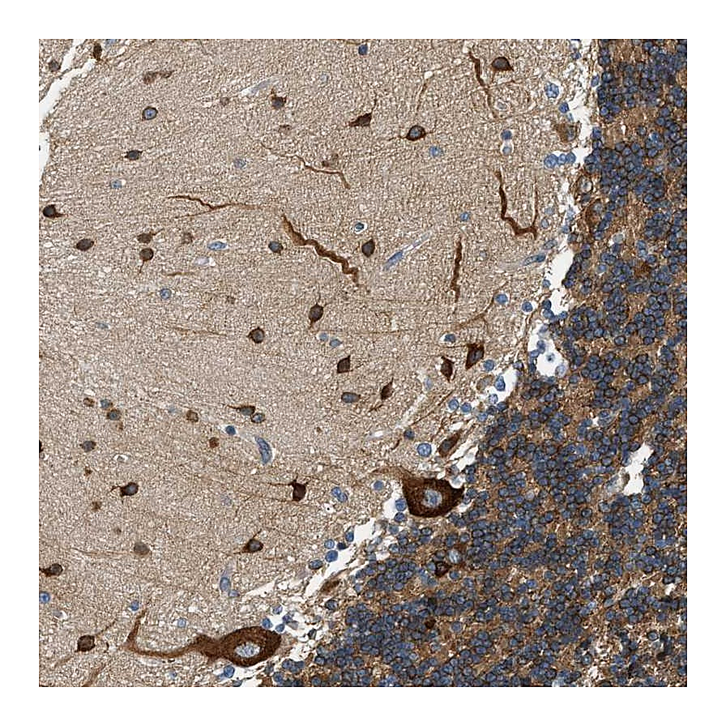 Atlas Antibodies Anti-KDELR2 Antibody