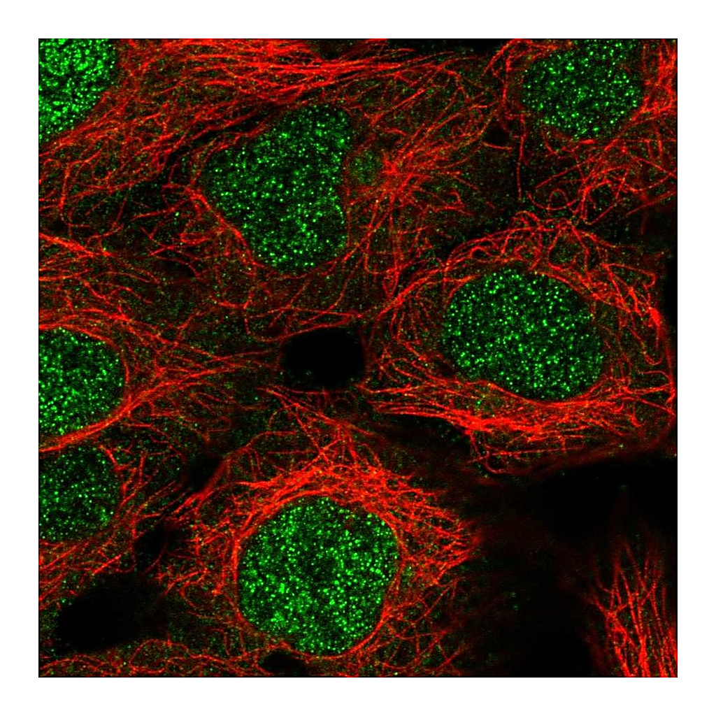 Atlas Antibodies Anti-KDELC1 Antibody