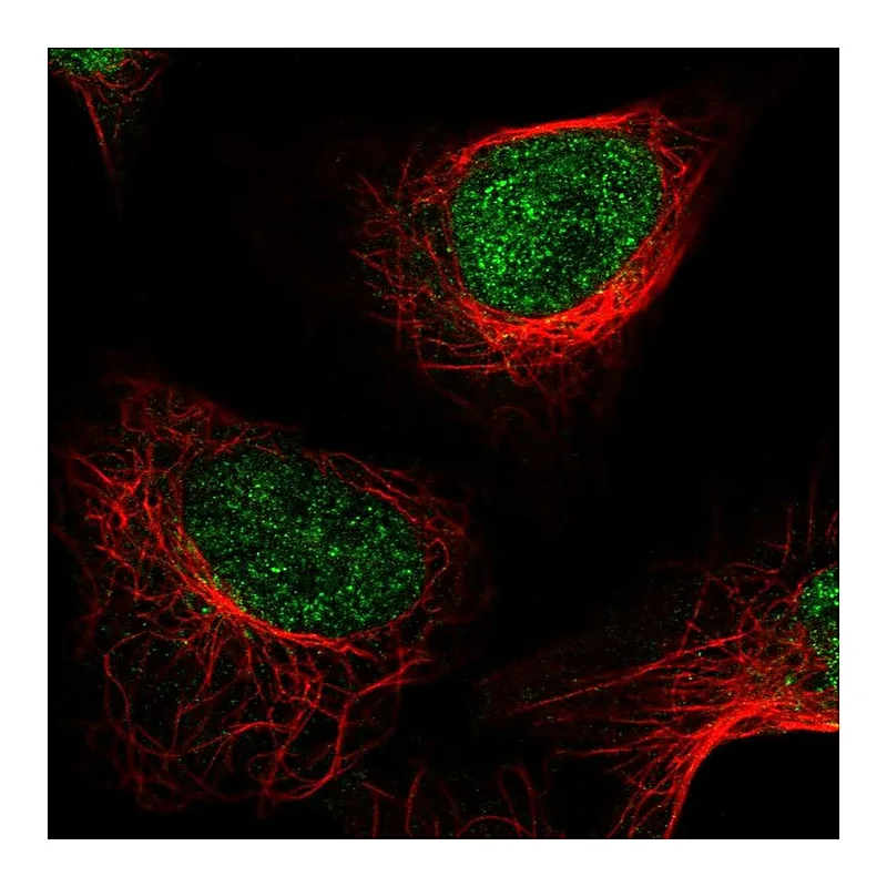 Atlas Antibodies Anti-KDM1A Antibody
