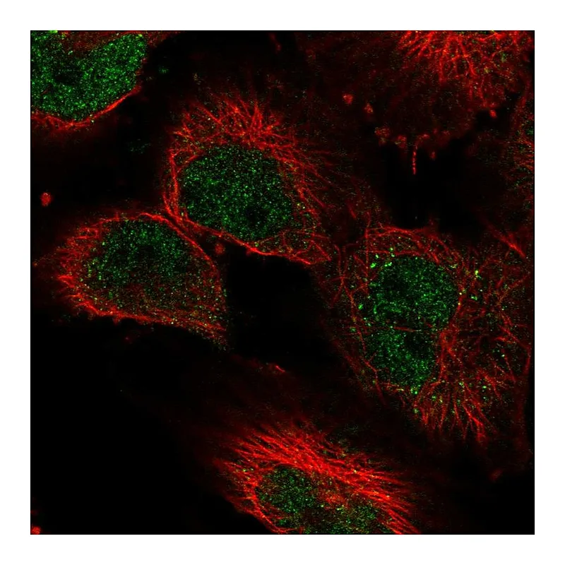 Atlas Antibodies Anti-KDM3A Antibody