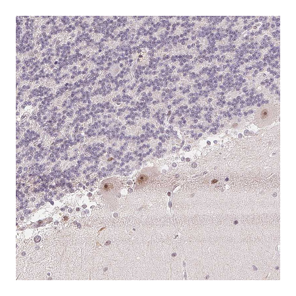 Atlas Antibodies Anti-KDM4D Antibody
