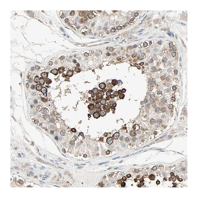 Atlas Antibodies Anti-KDM4A Antibody