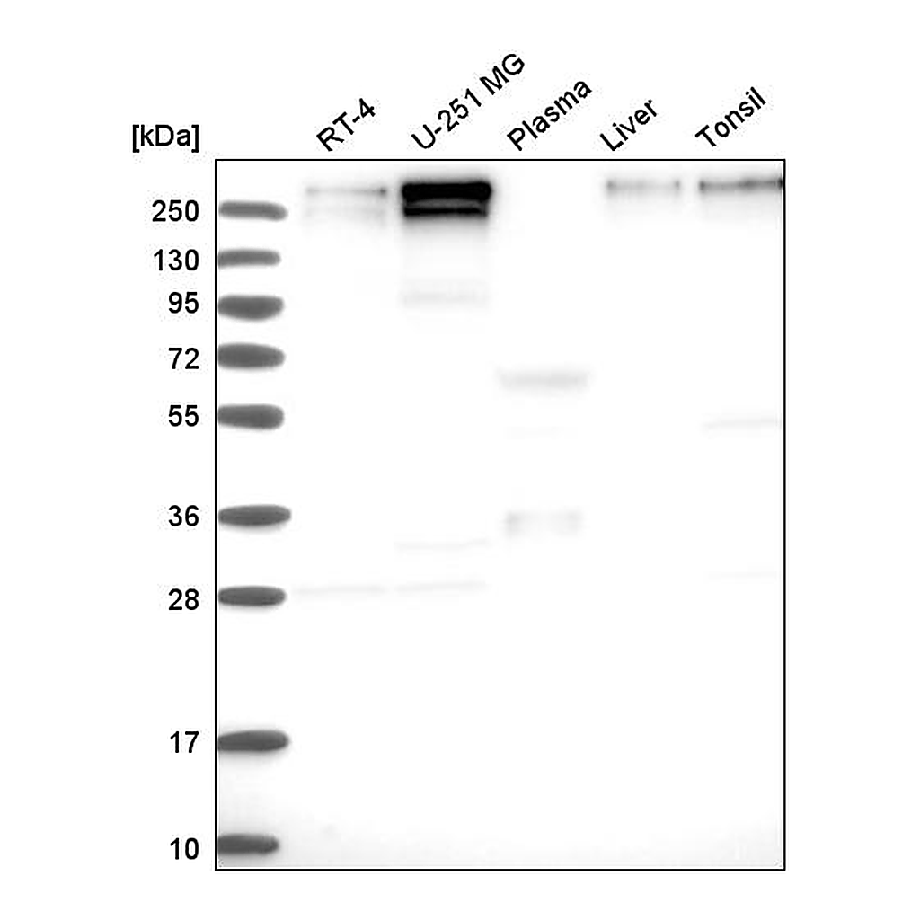 Atlas Antibodies Anti-KDM5C Antibody