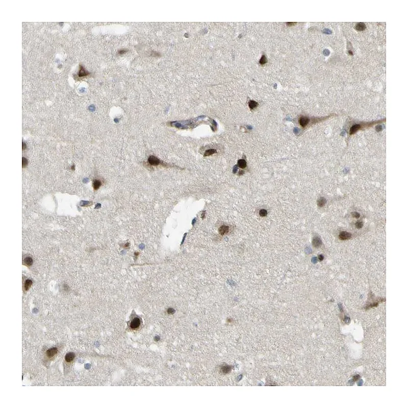 Atlas Antibodies Anti-KDM7A Antibody