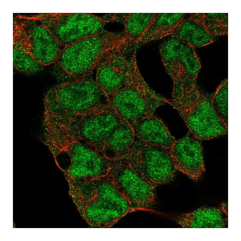 Atlas Antibodies Anti-KDM5C Antibody