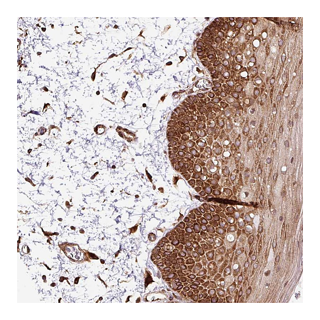 Atlas Antibodies Anti-KDM4E Antibody