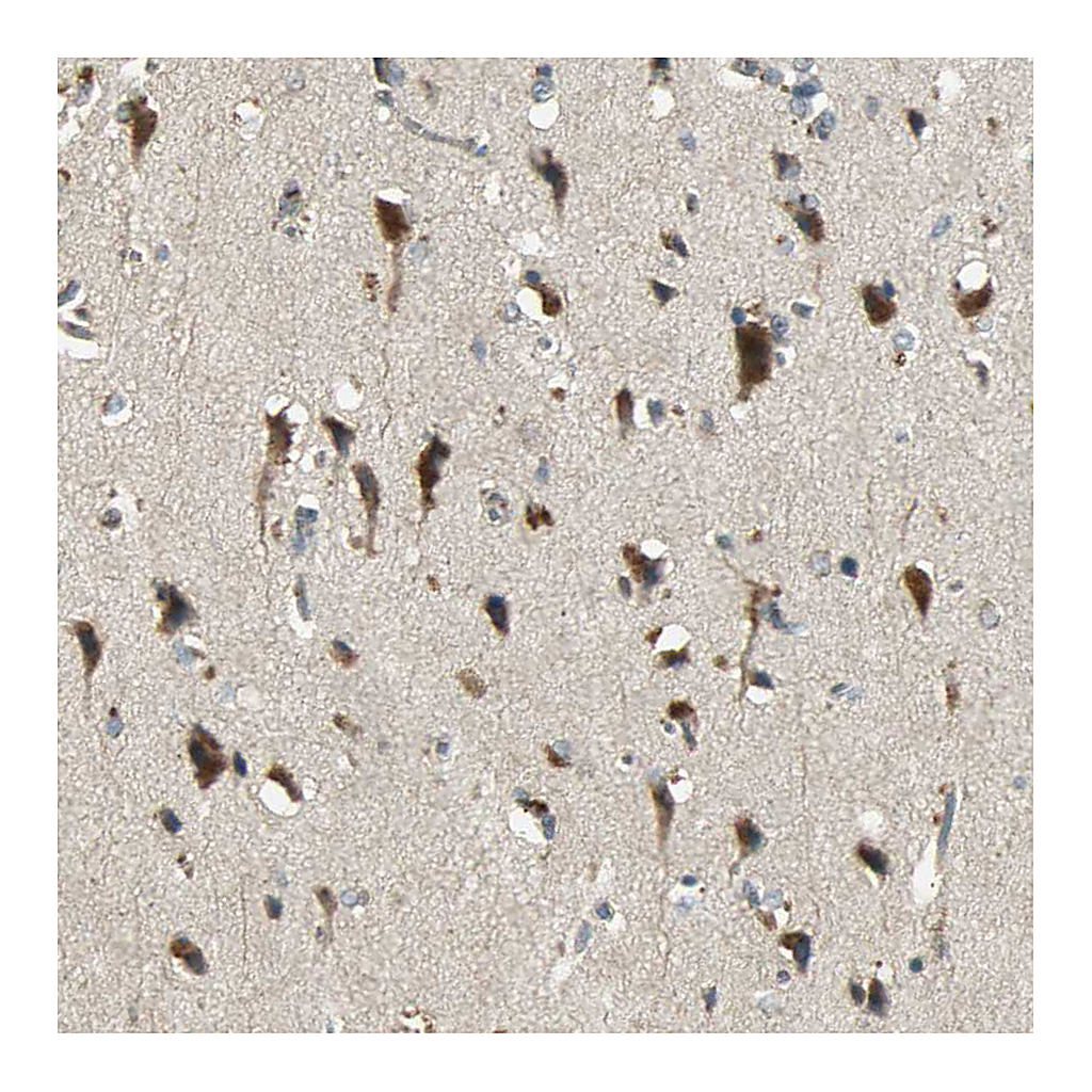 Atlas Antibodies Anti-KEAP1 Antibody