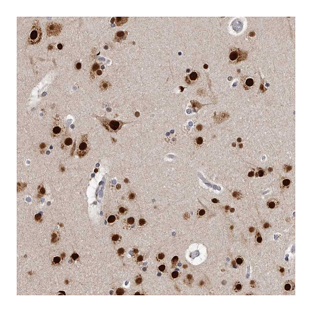 Atlas Antibodies Anti-KHDRBS2 Antibody