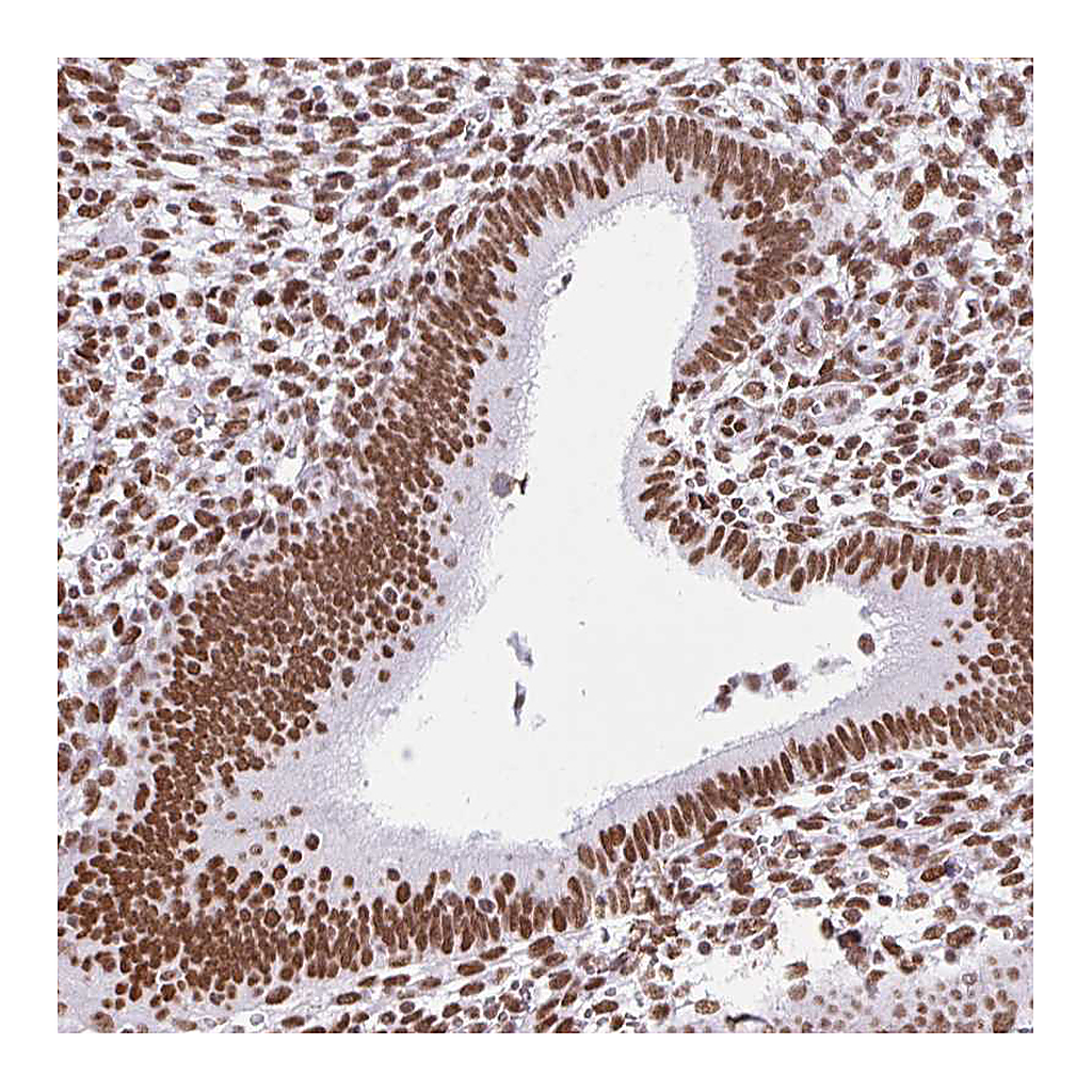 Atlas Antibodies Anti-KHDRBS1 Antibody