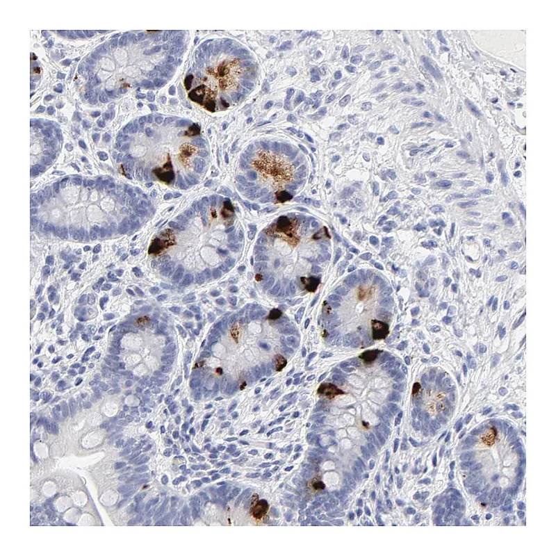 Atlas Antibodies Anti-KHNYN Antibody