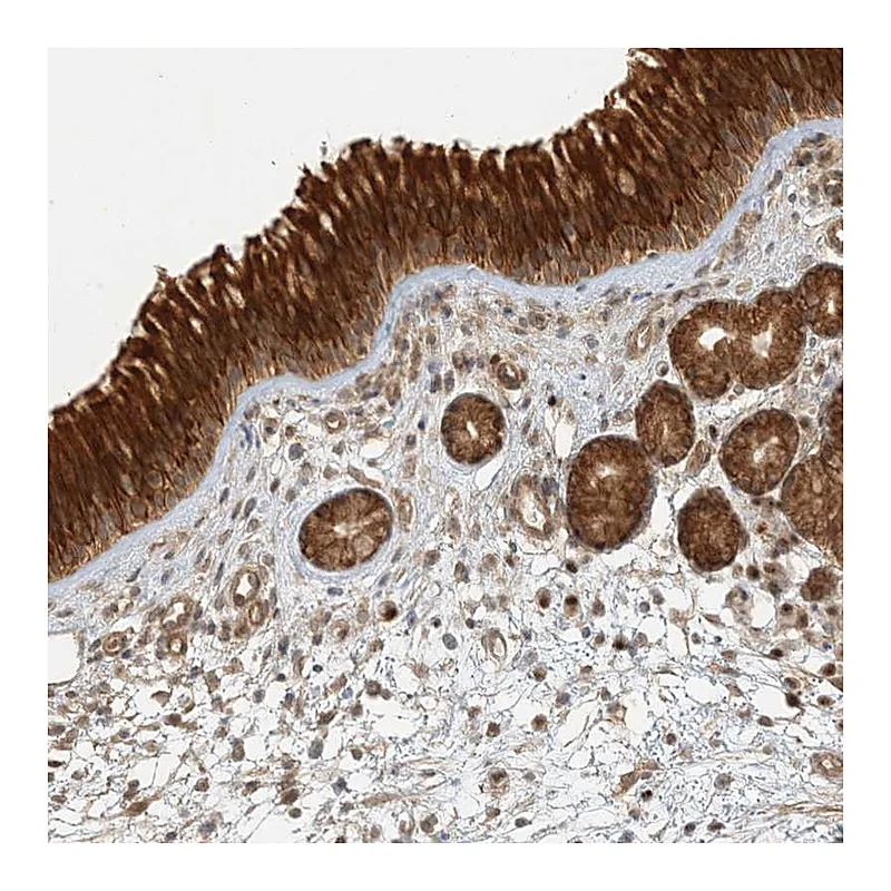 Atlas Antibodies Anti-KIAA0232 Antibody